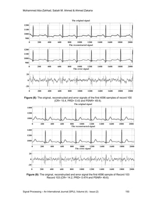 ECG Signal Compression Technique Based on Discrete Wavelet Transform ...