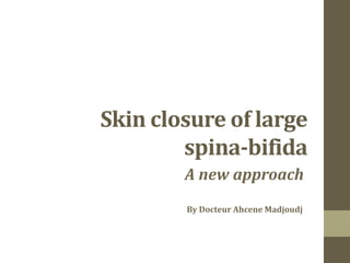 Skin closure of large
        spina-bifida
        A new approach
        By Docteur Ahcene Madjoudj
 