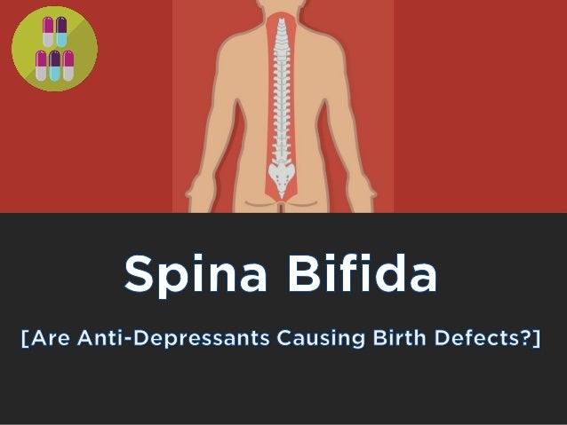 the congenital defect of spina bifida Spina bifida definition, a congenital neural tube defect in which part of the meninges or spinal cord protrudes through the spinal column. the congenital defect of spina bifida Spina bifida definition, a congenital neural tube defect in which part of the meninges or spinal cord protrudes through the spinal column.