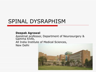 SPINAL DYSRAPHISM Deepak Agrawal Assistnat professor, Department of Neurosurgery & Gamma Knife, All India Institute of Medical Sciences, New Delhi 