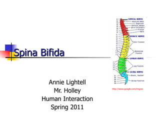 Spina Bifida   Annie Lightell Mr. Holley Human Interaction Spring 2011 http:// www.google.com/imgres 