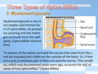 “A	
  section	
  of	
  the	
  spinal	
  cord	
  and	
  the	
  nerves	
  that	
  stem	
  from	
  the	
  c
ord	
  are	
  exposed	
  and	
  visible	
  on	
  the	
  outside	
  of	
  the	
  body.	
  Or,	
  if	
  ther
e	
  is	
  a	
  cyst,	
  it	
  encloses	
  part	
  of	
  the	
  cord	
  and	
  the	
  nerves.	
  This	
  conditi
on,	
  which	
  was	
  documented	
  4000	
  years	
  ago,	
  accounts	
  for	
  94%	
  of	
  
cases	
  of	
  true	
  spina	
  biﬁda.”	
  (Spina	
  Biﬁda)
Myelomeningocele	
  is	
  the	
  m
ost	
  omplex	
  and	
  intense	
  for
m	
  of	
  spina	
  biﬁda.	
  Its	
  protect
ive	
  covering	
  and	
  the	
  menin
ges	
  protrude	
  from	
  the	
  spilt	
  
spine.	
  (Spina	
  Biﬁda	
  Informa
tion)
 