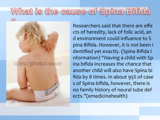 Researchers	
  said	
  that	
  there	
  are	
  eﬀe
cts	
  of	
  heredity,	
  lack	
  of	
  folic	
  acid,	
  an
d	
  environment	
  could	
  inﬂuence	
  to	
  S
pina	
  Biﬁda.	
  However,	
  it	
  is	
  not	
  been	
  i
dentiﬁed	
  yet	
  exactly.	
  (Spina	
  Biﬁda	
  I
nformation)	
  “Having	
  a	
  child	
  with	
  Sp
ina	
  biﬁda	
  increases	
  the	
  chance	
  that	
  
another	
  child	
  will	
  also	
  have	
  Spina	
  bi
ﬁda	
  by	
  8	
  times.	
  In	
  about	
  95%	
  of	
  case
s	
  of	
  Spina	
  biﬁda,	
  however,	
  there	
  is	
  
no	
  family	
  history	
  of	
  neural	
  tube	
  def
ects.”(emedicinehealth)
 