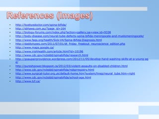 •  http://byebyedoctor.com/spina-bifida/
•  http://sbhawa.com.au/?page_id=164
•  http://biology-forums.com/index.php?action=gallery;sa=view;id=9338
•  http://body-disease.com/neural-tube-defects-spina-bifida-meningocele-and-myelomeningocele/
•  http://www.faqs.org/health/Sick-V4/Spina-Bifida-Diagnosis.html
•  http://daddytypes.com/2011/07/01/dt_friday_freakout_neuroscience_edition.php
•  http://www.maps.google.ca/
•  http://www.irishhealth.com/article.html?id=10196
•  http://www.cdc.gov/ncbddd/spinabifida/research.html
•  http://goaupairprovidence.wordpress.com/2012/11/05/develop-hand-washing-skills-at-a-young-ag
e/
•  http://pureshpower.blogspot.ca/2012/03/violent-assaults-on-disabled-children.html
•  http://www.cdc.gov/ncbddd/spinabifida/nsbprregistry.html
•  http://www.surgical-tutor.org.uk/default-home.htm?system/hnep/neural_tube.htm~right
•  http://www.cdc.gov/ncbddd/spinabifida/school-age.html
•  http://www.tcf.ca/
 