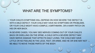 WHAT ARE THE SYMPTOMS?
• YOUR CHILD’S SYMPTOMS WILL DEPEND ON HOW SEVERE THE DEFECT IS.
WITH A MILD DEFECT, YOUR CHILD MAY HAVE NO SYMPTOMS OR PROBLEMS.
OR YOUR CHILD MIGHT HAVE A DIMPLE, A BIRTHMARK, OR A HAIRY PATCH ON
HIS OR HER BACK.
• IN SEVERE CASES, YOU MAY SEE NERVES COMING OUT OF YOUR CHILD’S
BACK OR SWELLING ON THE SPINE. A CHILD WITH A SEVERE DEFECT MAY
HAVE NERVE DAMAGE THAT AFFECTS DAILY LIVING. THE CHILD MAY HAVE
LITTLE OR NO FEELING IN THE LEGS, FEET, OR ARMS. AND HE OR SHE MAY NOT
BE ABLE TO MOVE THOSE PARTS OF THE BODY.
 