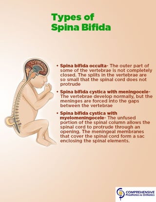Spina Bifida