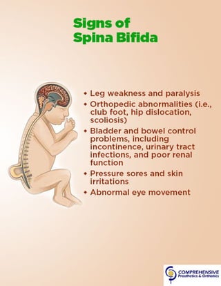Spina Bifida