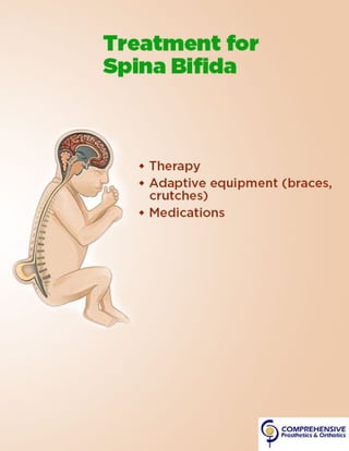 Spina Bifida