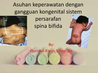 Asuhan keperawatan dengan 
gangguan kongenital sistem 
persarafan 
spina bifida 
By: 
Qurotul A’yun,S.Kep.,Ns 
 