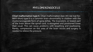 MYELOMENINGOCELE
Chiari malformation type II. Chiari malformation (kee-AH-ree mal-for-
MAY-shun) type II is a common brain abnormality in children with the
myelomeningocele form of spina bifida. The brainstem, or lowest part
of the brain above the spinal cord, is elongated and positioned lower
than usual. This can cause problems with breathing and swallowing.
Rarely, compression on this area of the brain occurs and surgery is
needed to relieve the pressure.
 