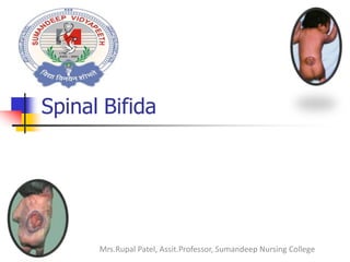 Spinal Bifida
Mrs.Rupal Patel, Assit.Professor, Sumandeep Nursing College
 