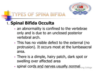 1. Spinal Bifida Occulta
 an abnormality is confined to the vertebrae
only and is due to an unclosed posterior
vertebral arch.
 This has no visible defect to the external (no
protrusion). It occurs most at the lumbasacral
area.
 There is a dimple, hairy patch, dark spot or
swelling over affected area
 spinal cords and nerves usually normalMrs.Rupal Patel, Assit.Professor, Sumandeep Nursing College
 