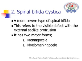 2. Spinal bifida Cystica
 A more severe type of spinal bifida
 This refers to the visible defect with the
external saclike protrusion
 It has two major forms;
1. Meningocele
2. Myelomeningocele
Mrs.Rupal Patel, Assit.Professor, Sumandeep Nursing College
 