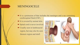 MENINGOCELE
 It is a protrusion of that includes the meninges and a sac containing
cerebrospinal fluid (CSF).
 It is covered by normal skin.
 Spinal cord is never involved.
 Usually seen in lumbosacral
region, but may also be seen
thoracic region and skull.
 