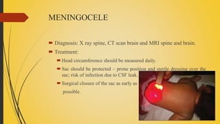 MENINGOCELE
 Diagnosis: X ray spine, CT scan brain and MRI spine and brain.
 Treatment:
Head circumference should be measured daily.
Sac should be protected – prone position and sterile dressing over the
sac; risk of infection due to CSF leak.
Surgical closure of the sac as early as
possible.
 