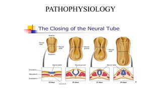 PATHOPHYSIOLOGY
 