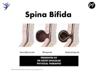 Spina Bifida
©2021 Dr Rohit Bhaskar PT https://www.pt-pedia.com/
PRESENTED BY
DR ROHIT BHASKAR
PHYSICAL THERAPIST
 