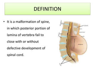 DEFINITION
• It is a malformation of spine,
in which posterior portion of
lamina of vertebra fail to
close with or without
defective development of
spinal cord.
 