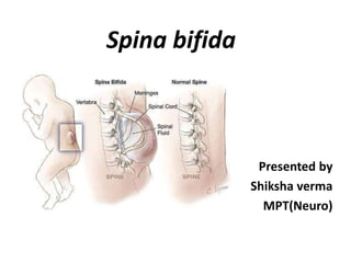 Spina bifida
Presented by
Shiksha verma
MPT(Neuro)
 