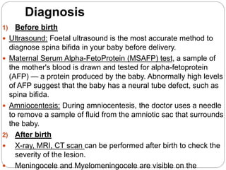 Spina Bifida.pptx
