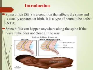 SPINA BIFIDA POWER POINT PRESENTATION FOR NURSES | PPT