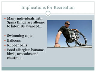Implications for Recreation
 Many individuals with
Spina Bifida are allergic
to latex. Be aware of…
 Swimming caps
 Balloons
 Rubber balls
 Food allergies: bananas,
kiwis, avocados and
chestnuts
 