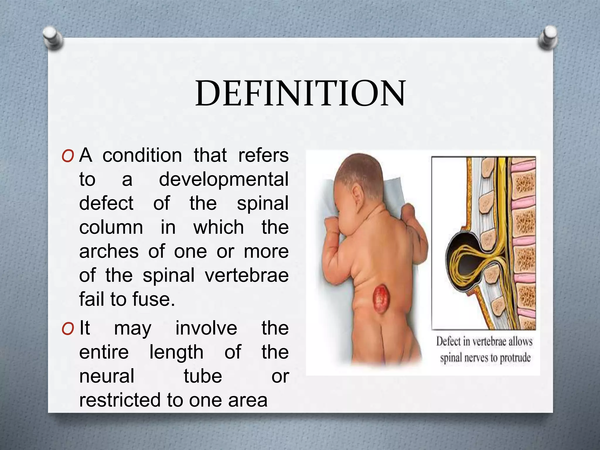 Spina Bifida Child Health Nursing PPTX