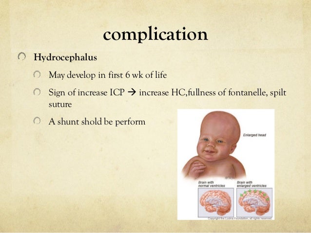 spina bifida myelomeningocele repair treatment and complications myelomeningocele repair