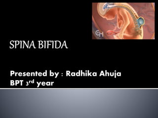 Spina bifida ppt | PPTX