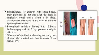 SPINA BIFIDA ppt.pptx upload powerpoint presentation | PPTX