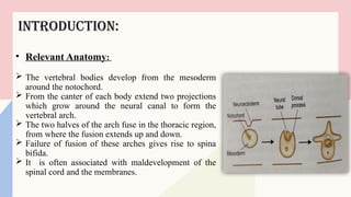 SPINA BIFIDA ppt.pptx upload powerpoint presentation | PPTX