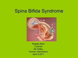 Spina Bifida Syndrome Rogelio Brito 2 period Mr.Holley Human interactions April 8 2011 