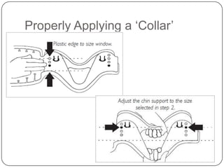 Properly Applying a ‘Collar’

 