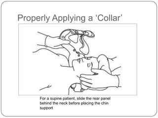 Properly Applying a ‘Collar’

For a supine patient, slide the rear panel
behind the neck before placing the chin
support

 