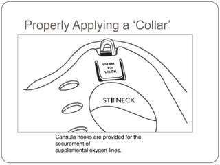 Properly Applying a ‘Collar’

Cannula hooks are provided for the
securement of
supplemental oxygen lines.

 