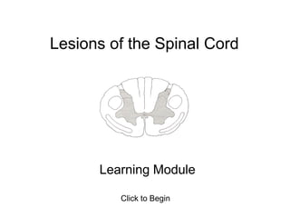 Lesions of the Spinal Cord
Learning Module
Click to Begin
 