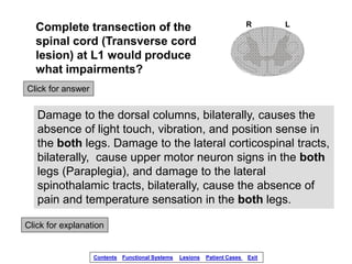 spinal-cord-injury-lesions.ppsx