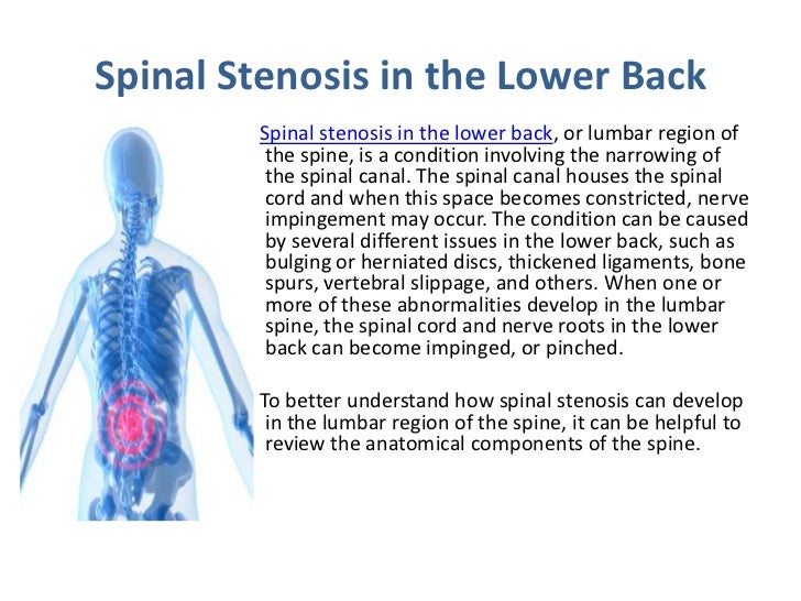 pic Stenosis Of The Lower Spine spinal stenosis back
