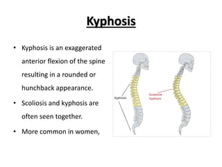 Kyphosis
• Kyphosis is an exaggerated
anterior flexion of the spine
resulting in a rounded or
hunchback appearance.
• Scoliosis and kyphosis are
often seen together.
• More common in women,
 