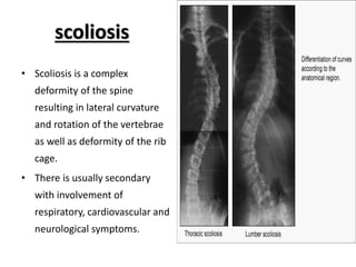 scoliosis
• Scoliosis is a complex
deformity of the spine
resulting in lateral curvature
and rotation of the vertebrae
as well as deformity of the rib
cage.
• There is usually secondary
with involvement of
respiratory, cardiovascular and
neurological symptoms.
 