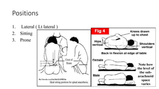 Positions
1. Lateral ( Lt lateral )
2. Sitting
3. Prone
 