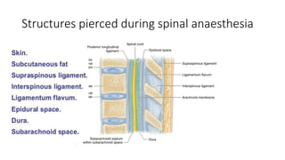 Structures pierced during spinal anaesthesia
 