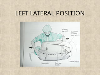 LEFT LATERAL POSITION
 