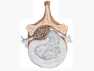 Spinal Presentation Spinal anatomy final | PPT