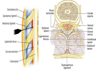 Spinal and Epidural Anaesthesia.pptx