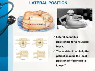 Spinal Block Positioning SPINAL AND EPIDURAL ANESTHEISA by Dr.Sravani Vishnubhatla | PPTX
