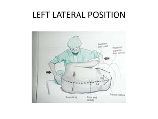 LEFT LATERAL POSITION
 