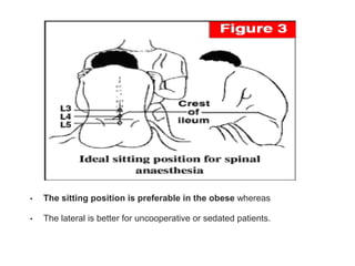 • The sitting position is preferable in the obese whereas
• The lateral is better for uncooperative or sedated patients.
 