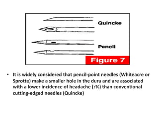 • It is widely considered that pencil-point needles (Whiteacre or
Sprotte) make a smaller hole in the dura and are associated
with a lower incidence of headache (1%) than conventional
cutting-edged needles (Quincke)
 