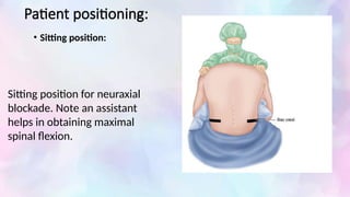 Spinal Block Positioning Comprehensive Overview of Spinal Anesthesia: History, Techniques, and ...